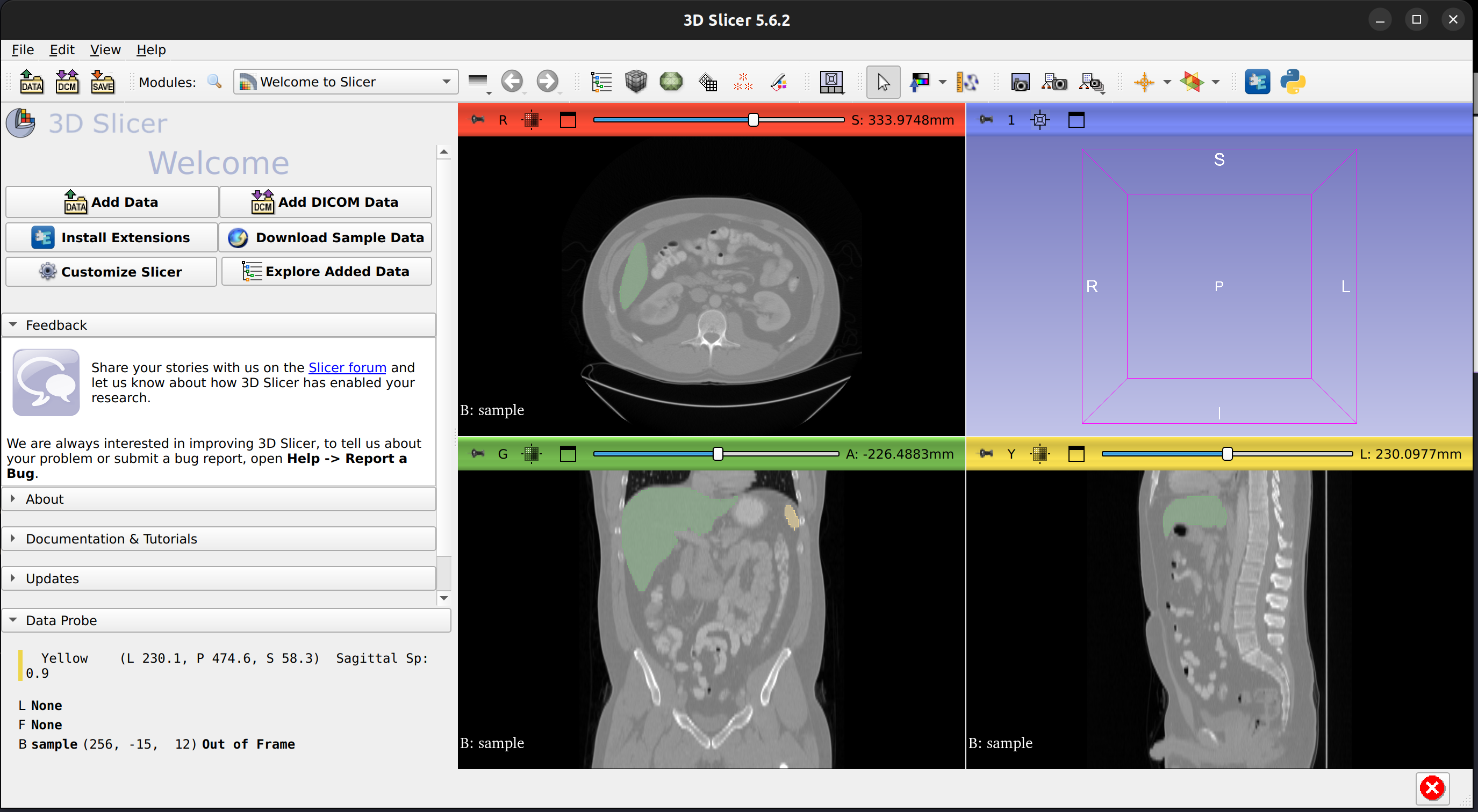 3D Slicer volume and segmentation display