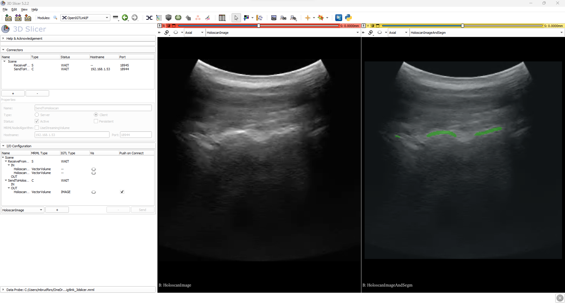 C++ ultrasound segmentation result