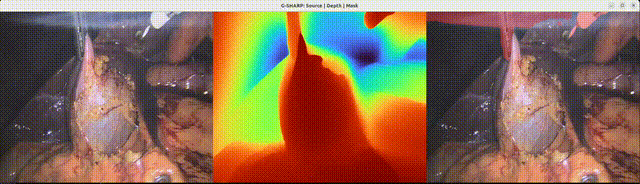 Phase 1 — Source | Depth | Mask (CMR surgical video)