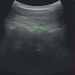 Ultrasound app