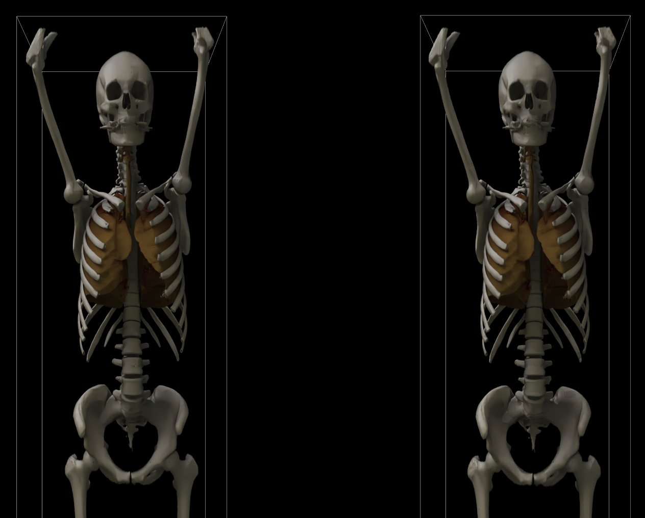 Volume Rendering Screenshot