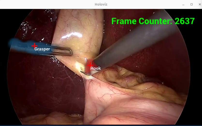 UCXX Endoscopy Tool Tracking