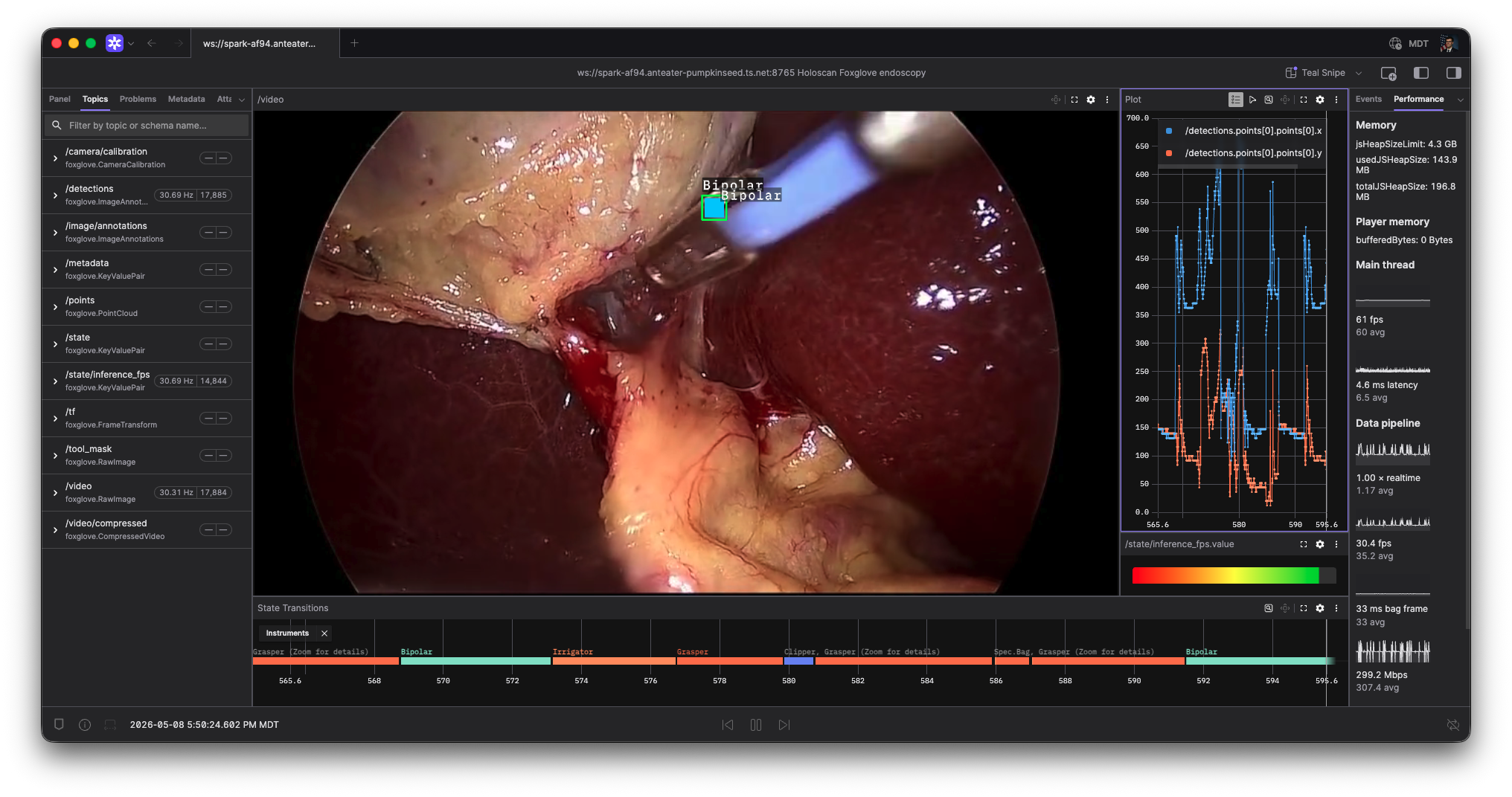 Foxglove endoscopy tool tracking
