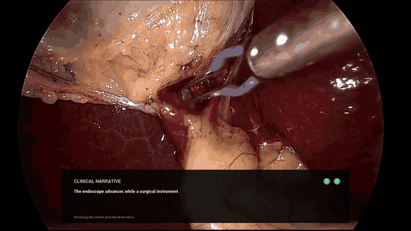 Procedural Narrator