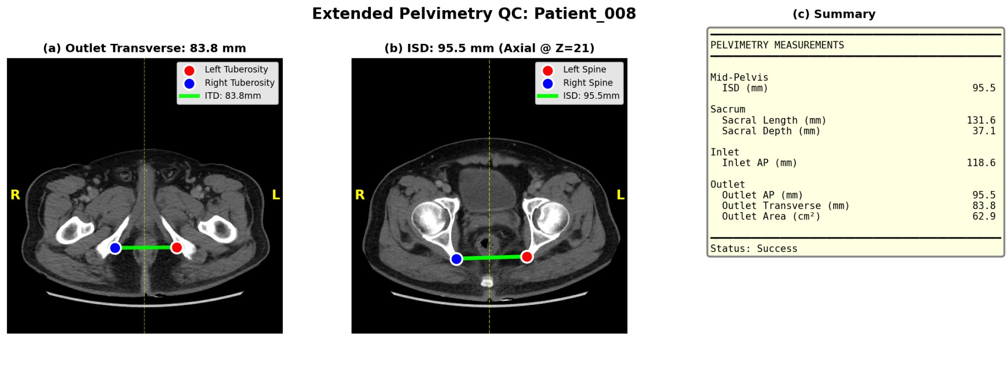 Extended QC Example — Axial views with measurement summary