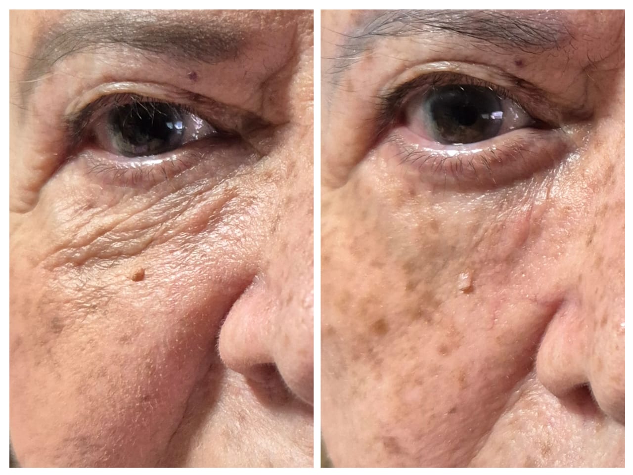 Caso real RIMAN: piel más firme y luminosa