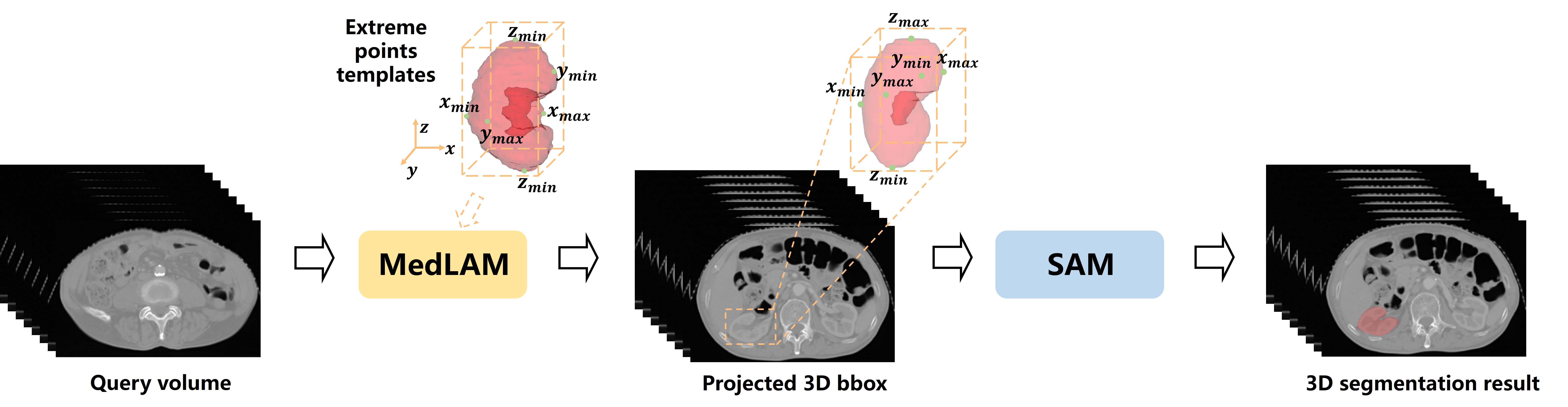 MedLSAM Image