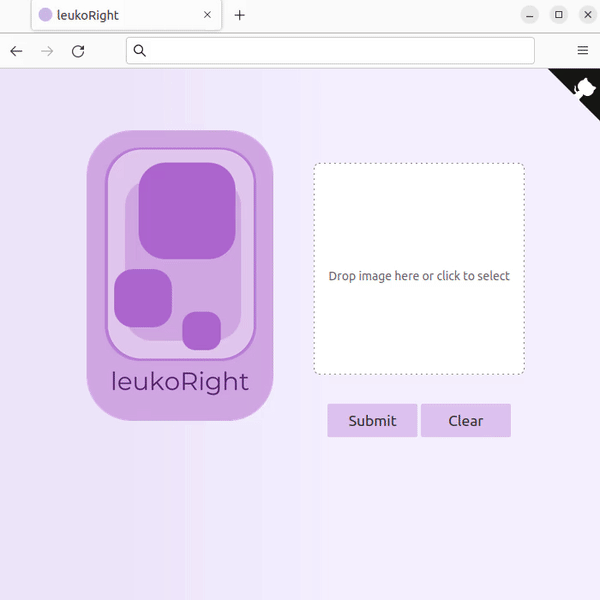 leukoRight web example