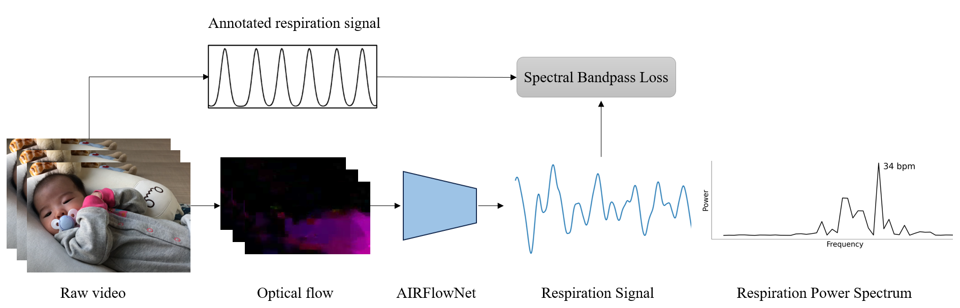 Infant respiration estimation from videos using AIRFlowNet.