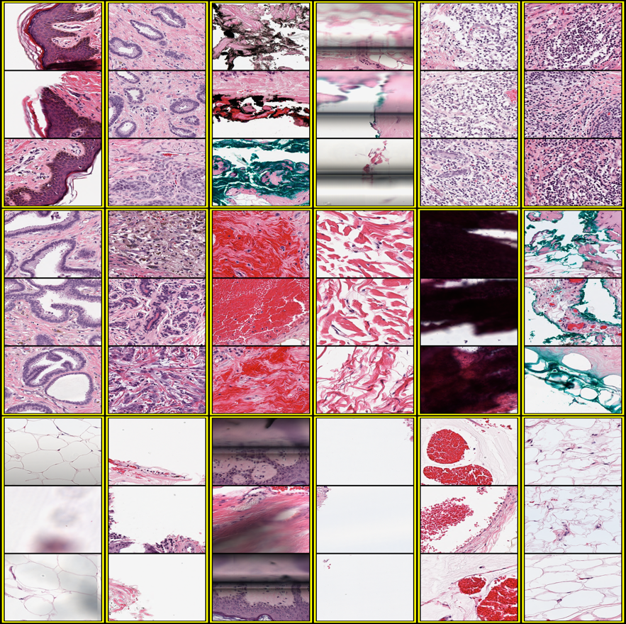 self supervised visual representation learning for histopathological images