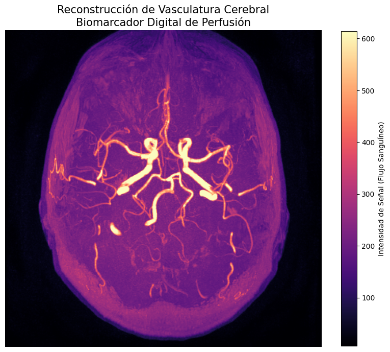 Hemodinámica Cerebral