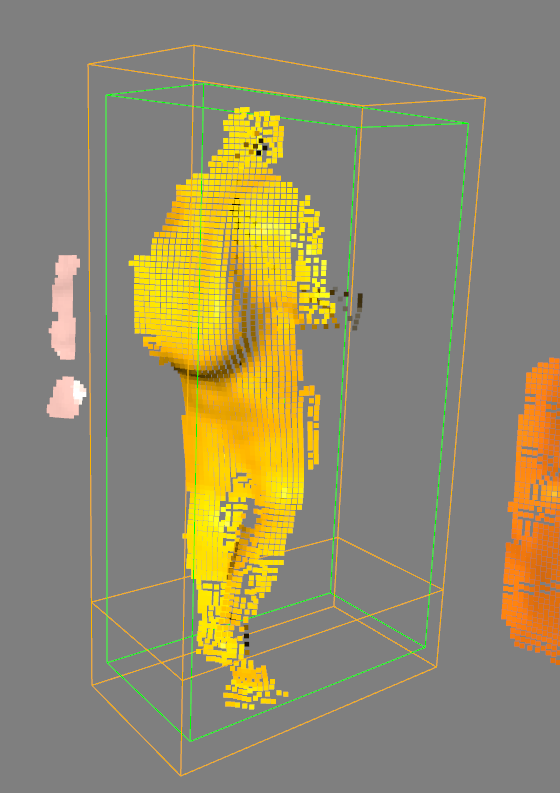 Top and Bottom bounding boxes