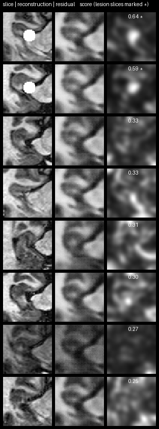 Test slices, VAE reconstructions and residual maps with scores
