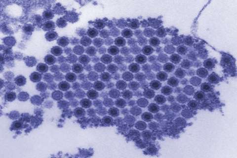 Chikungunya Virus