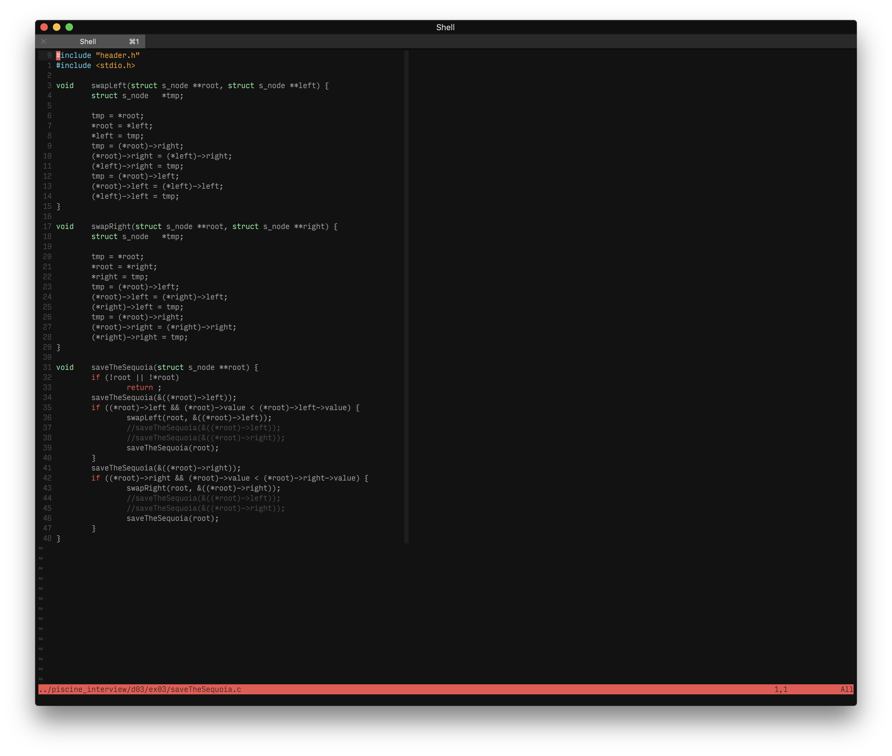 My neovim config