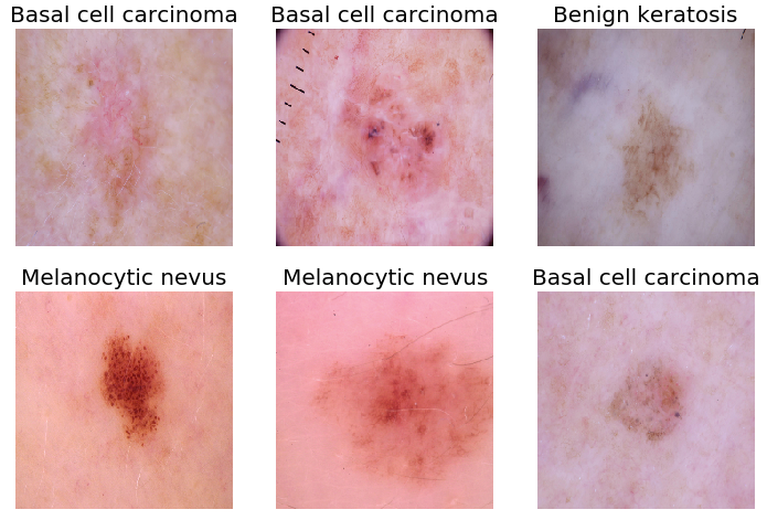 Skincancerclassification Isic