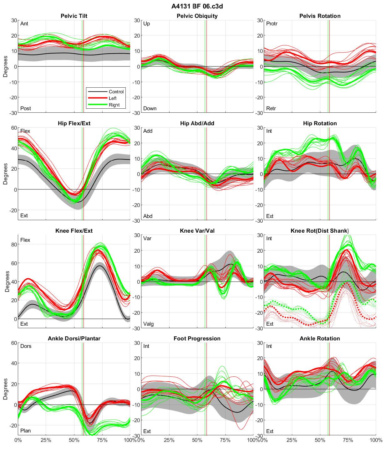 Joint Kinematic Plots