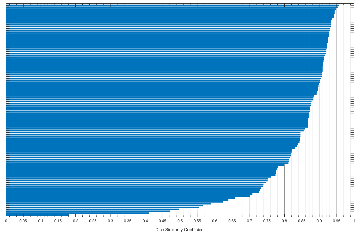 DSC distribution