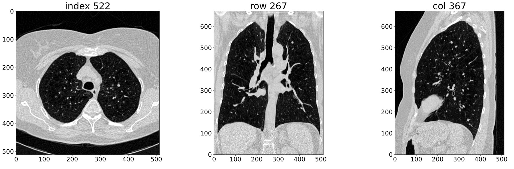 Section of a CT scan