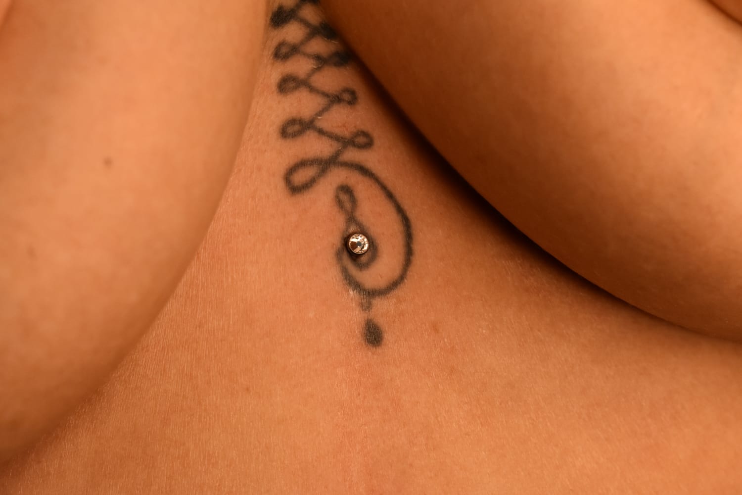 Microdermal y surface