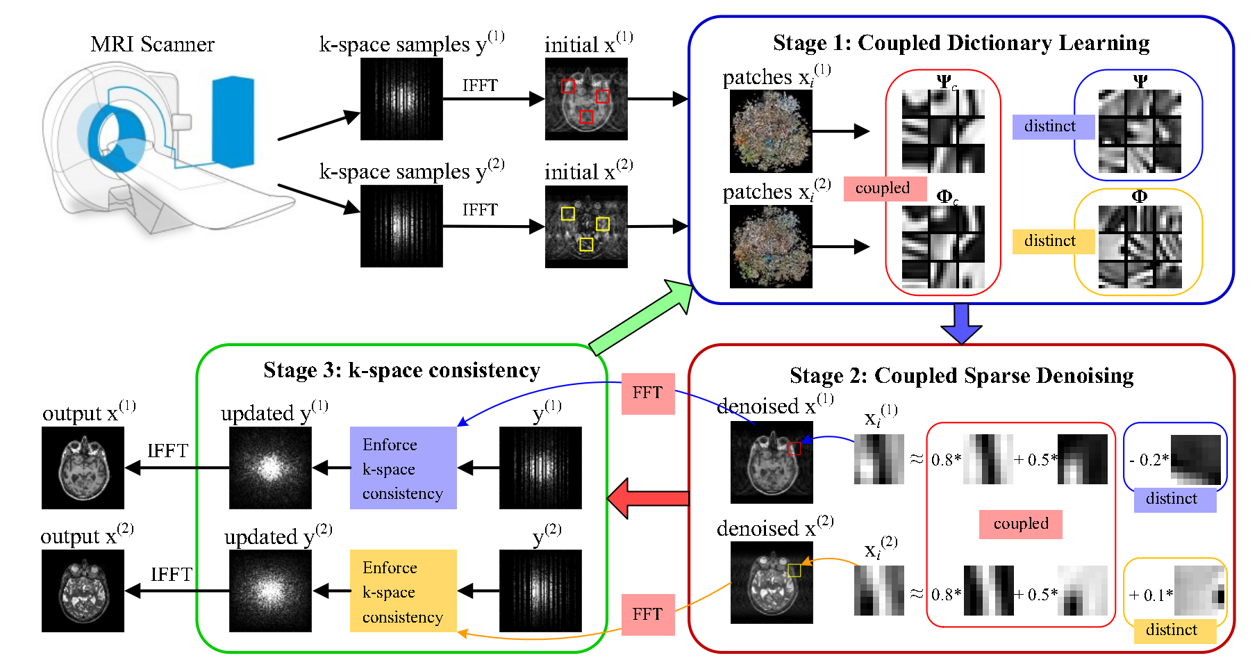 Figure: CDLMRI framework.