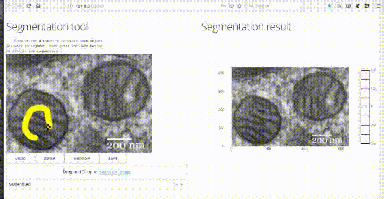 Segmentation app