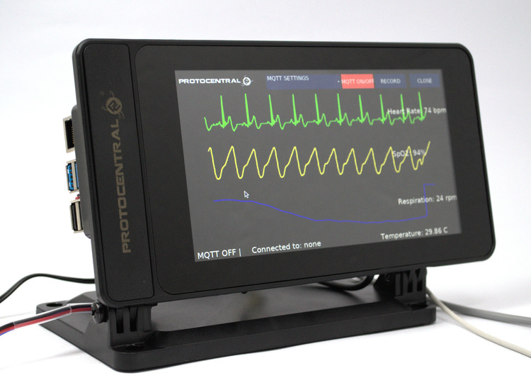 HealthyPi Display