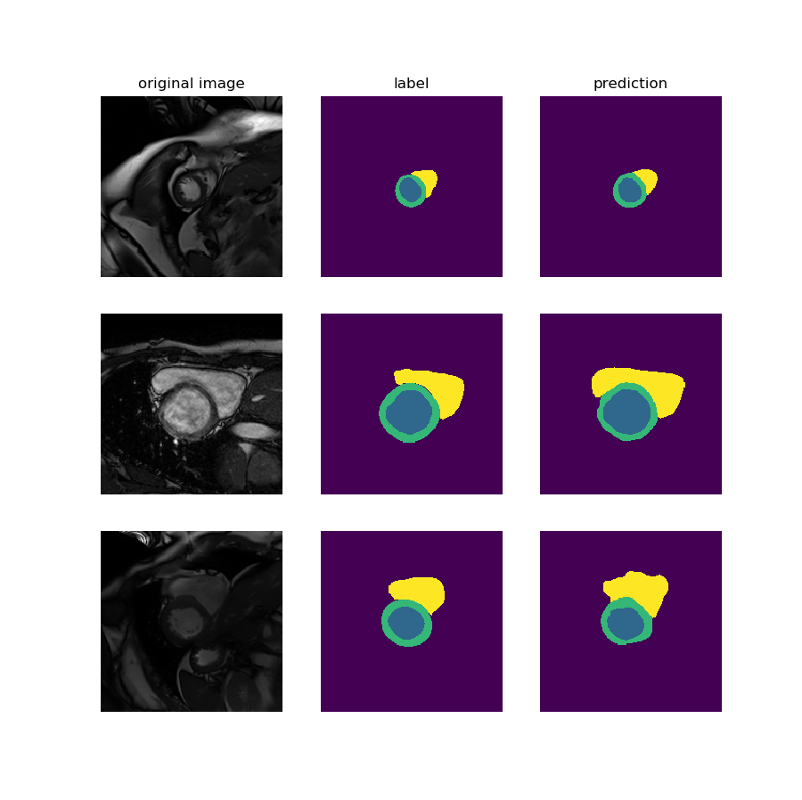 Segmentation examples