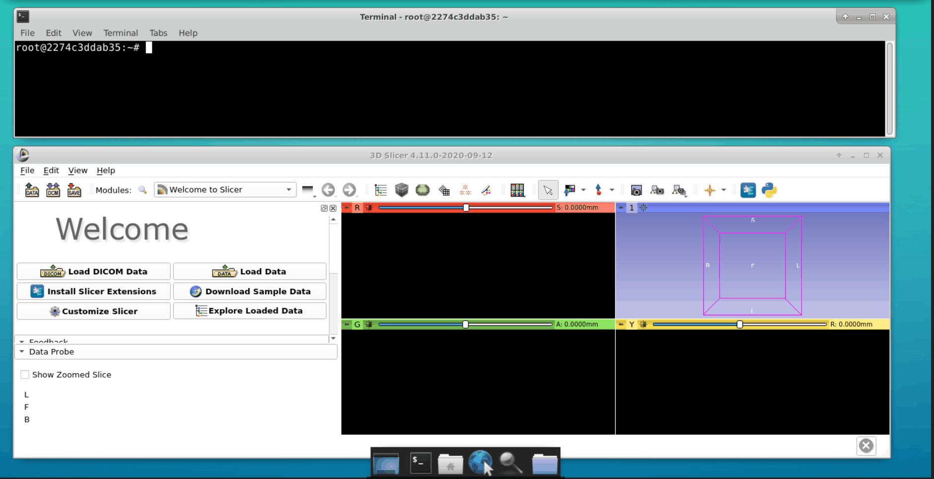 Load DICOM file