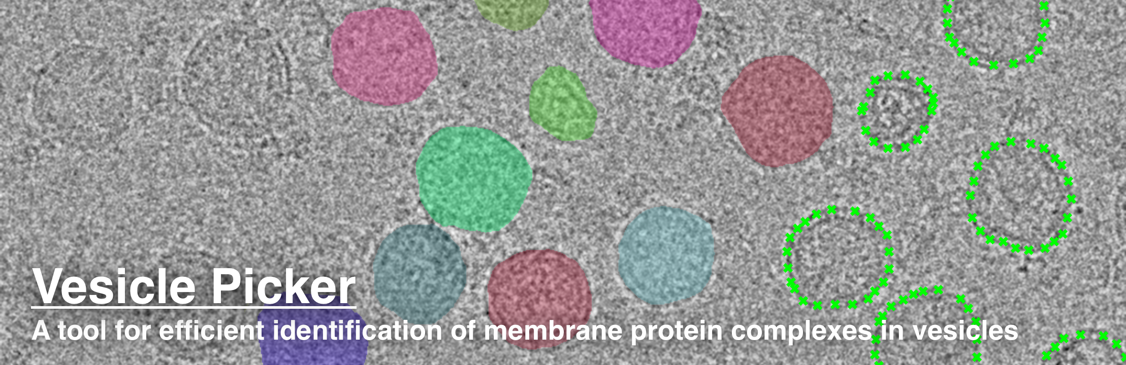 Vesicle Picker : Infrastructure for AI for Science | SciencePedia