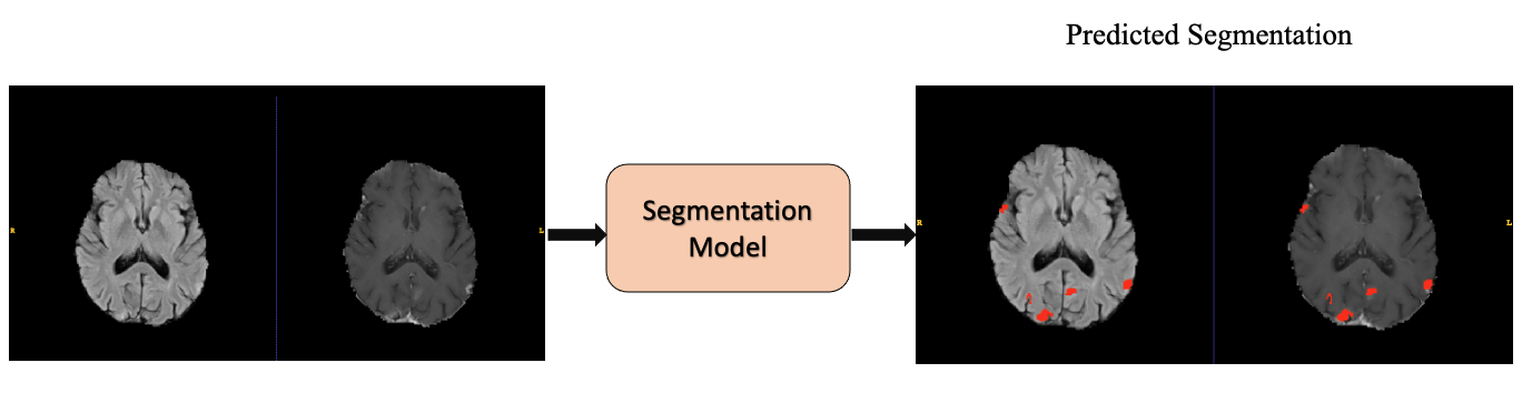 Seg_model