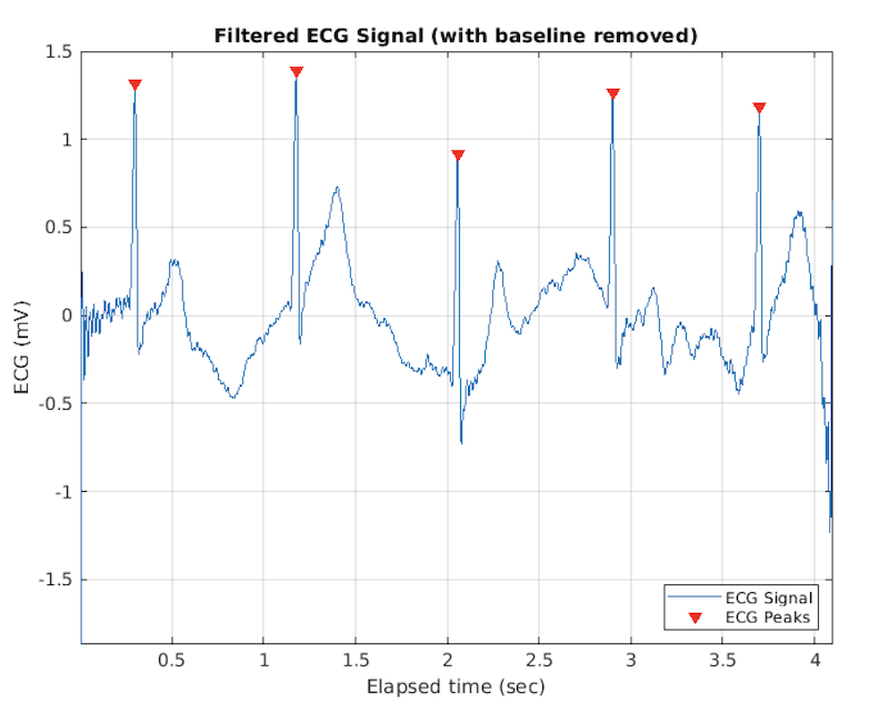 CleanedECGSignalNoBaseline