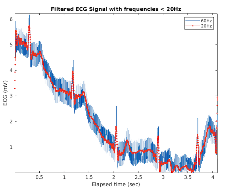 CleanedECGSignal