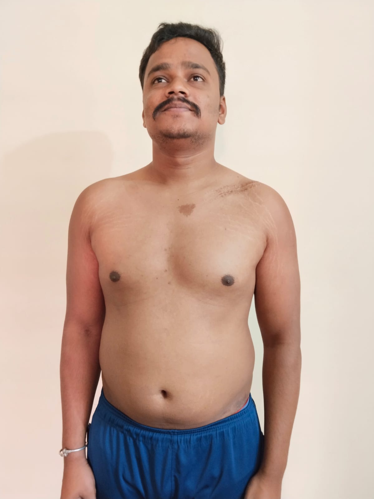 transformation photos