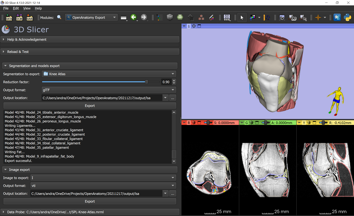 OpenAnatomy Exporter module screenshot