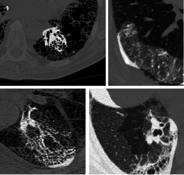 image classification results with critical factors highlighted by GSInquire