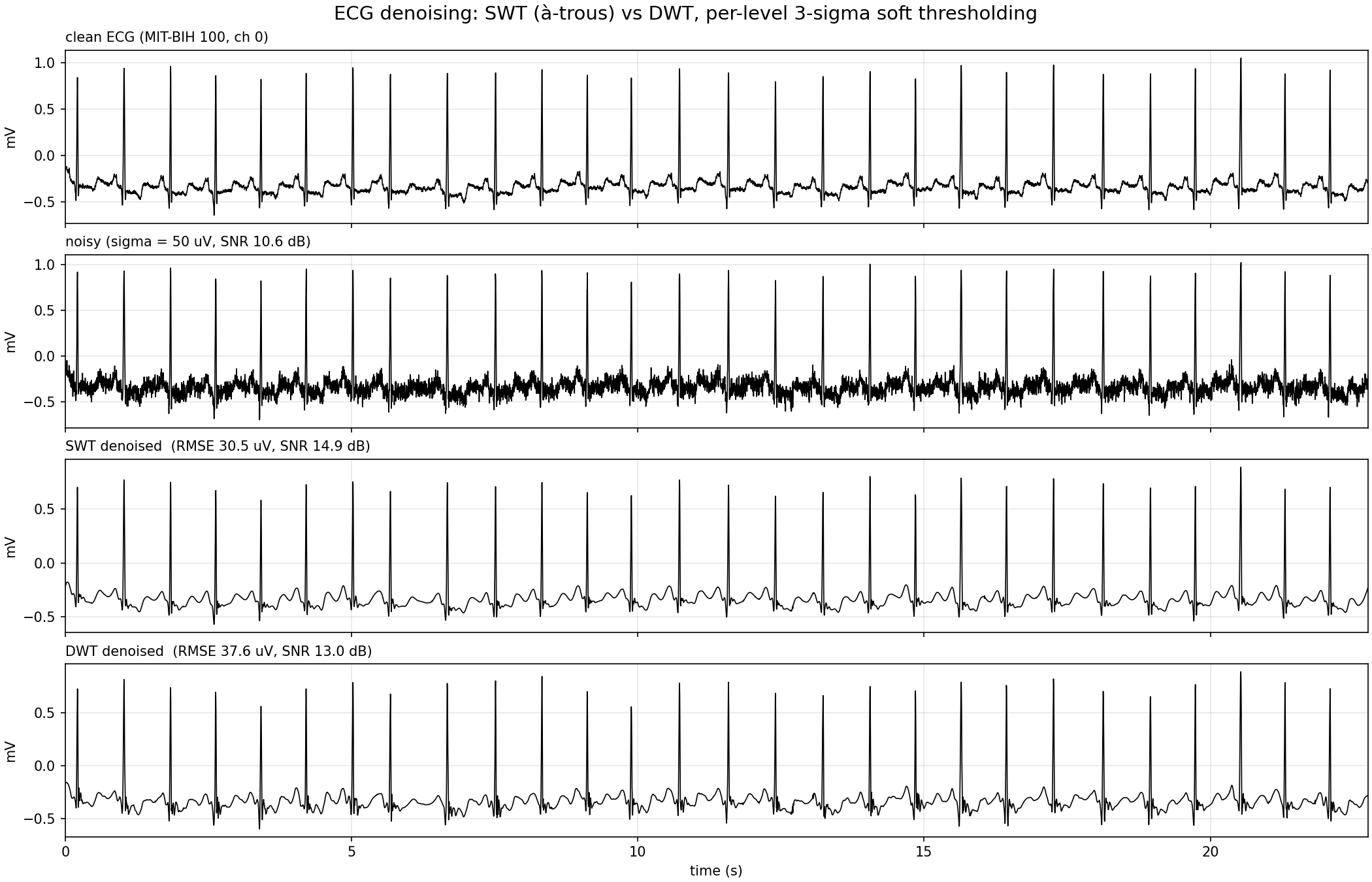 ecg denoising