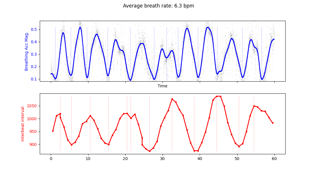 Breathing rate and heart rate peaks
