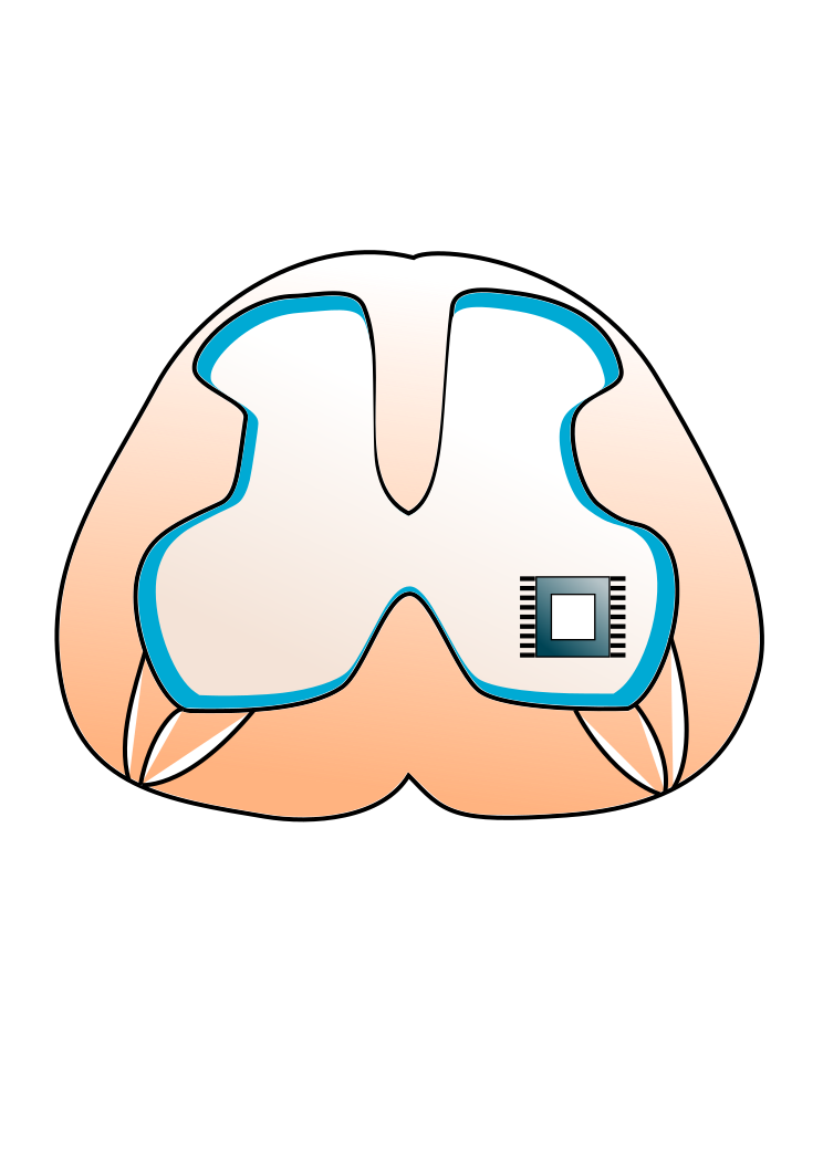 memristive-spinal-cord