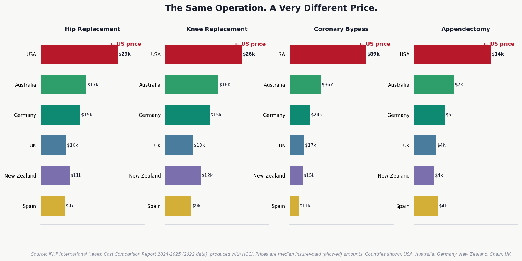 International Procedure Price Comparison