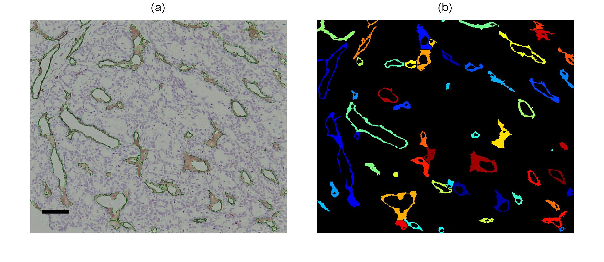 Chromatic Analysis