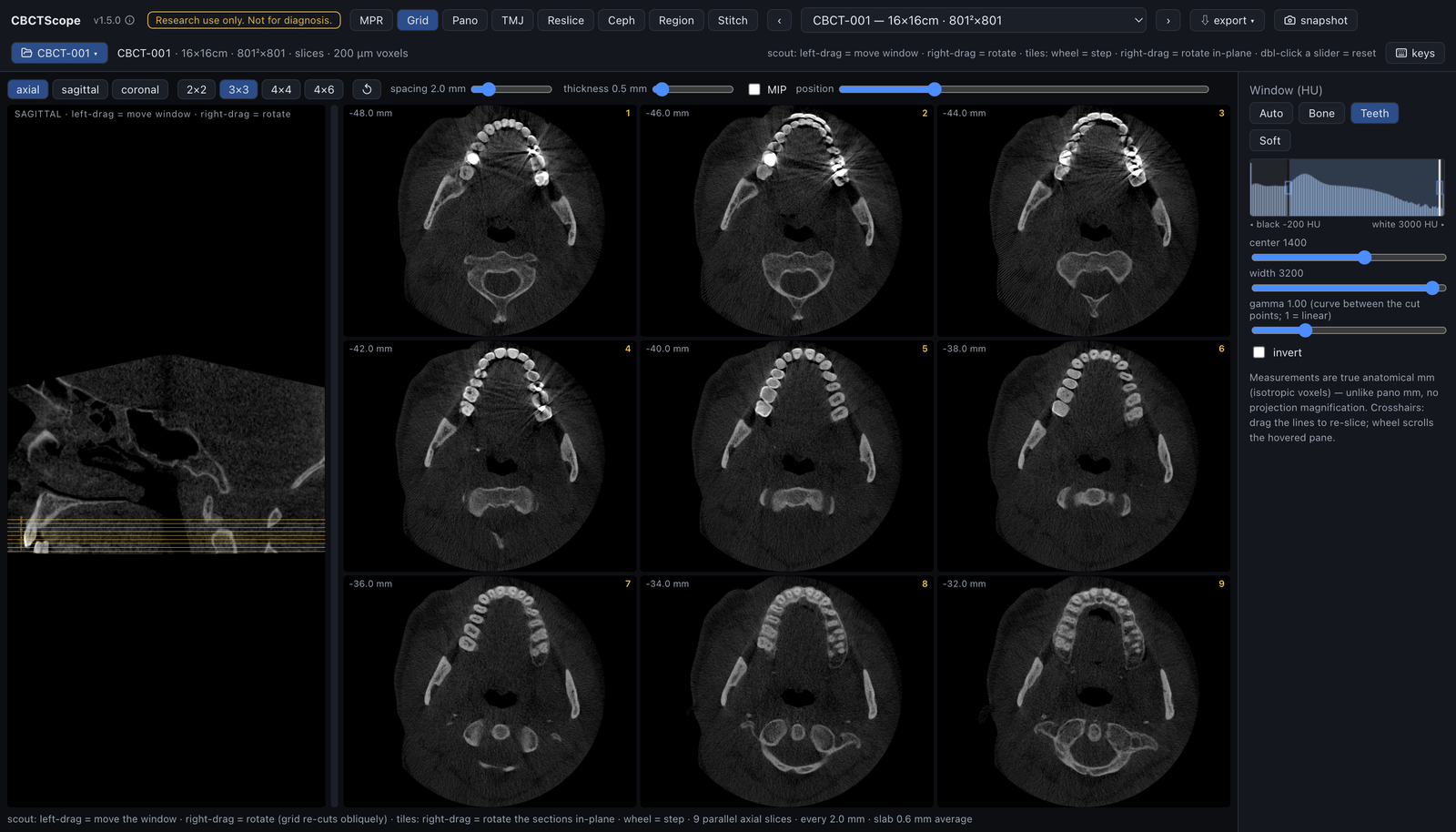 Grid: nine parallel axial slices through the dentition with a sagittal scout, spacing and thickness controls