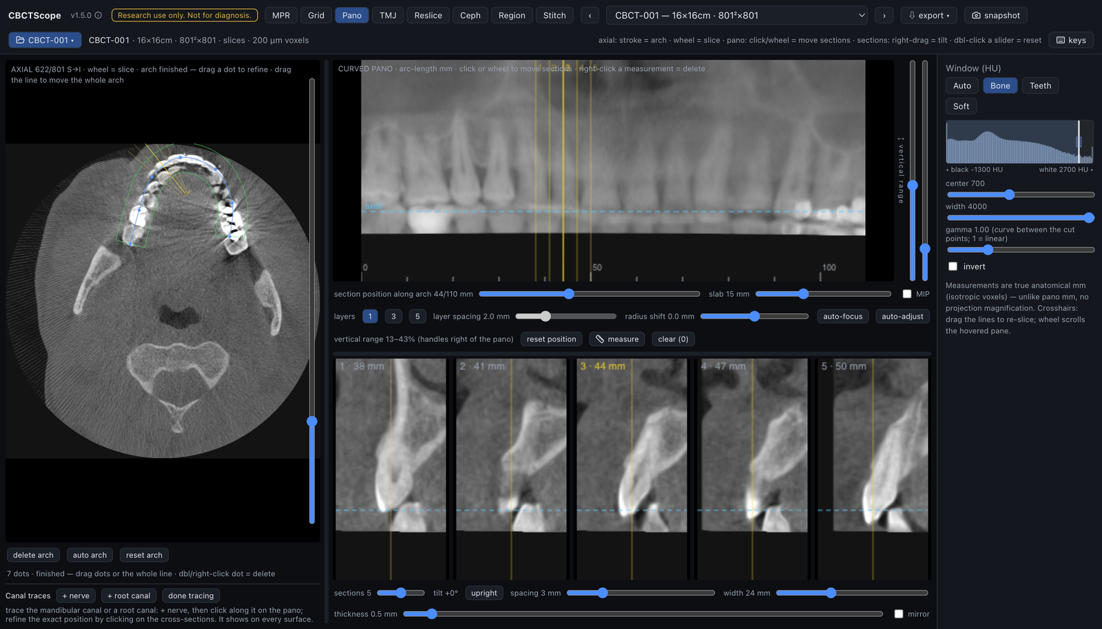 Pano: arch spline on the axial, curved panoramic of the arch, perpendicular cross-sections