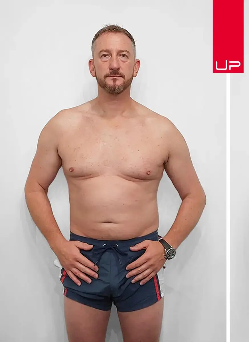 Before Transformation 2