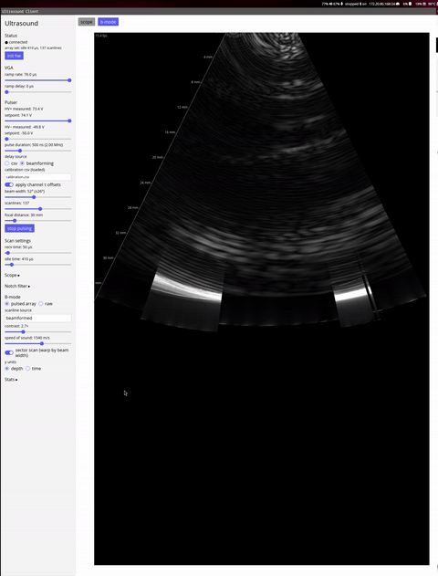Ultrasound, from the project README
