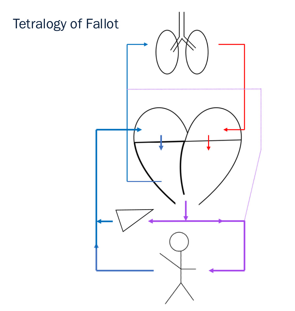 sketch_of_tof_bloodflow
