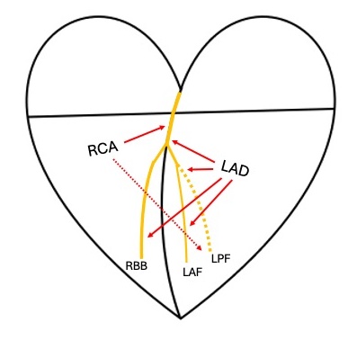 14_blood_supply_RCA_LAD