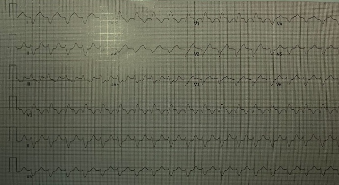 1_initial_EKG