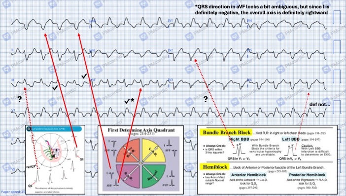 9_ekg_with_findings
