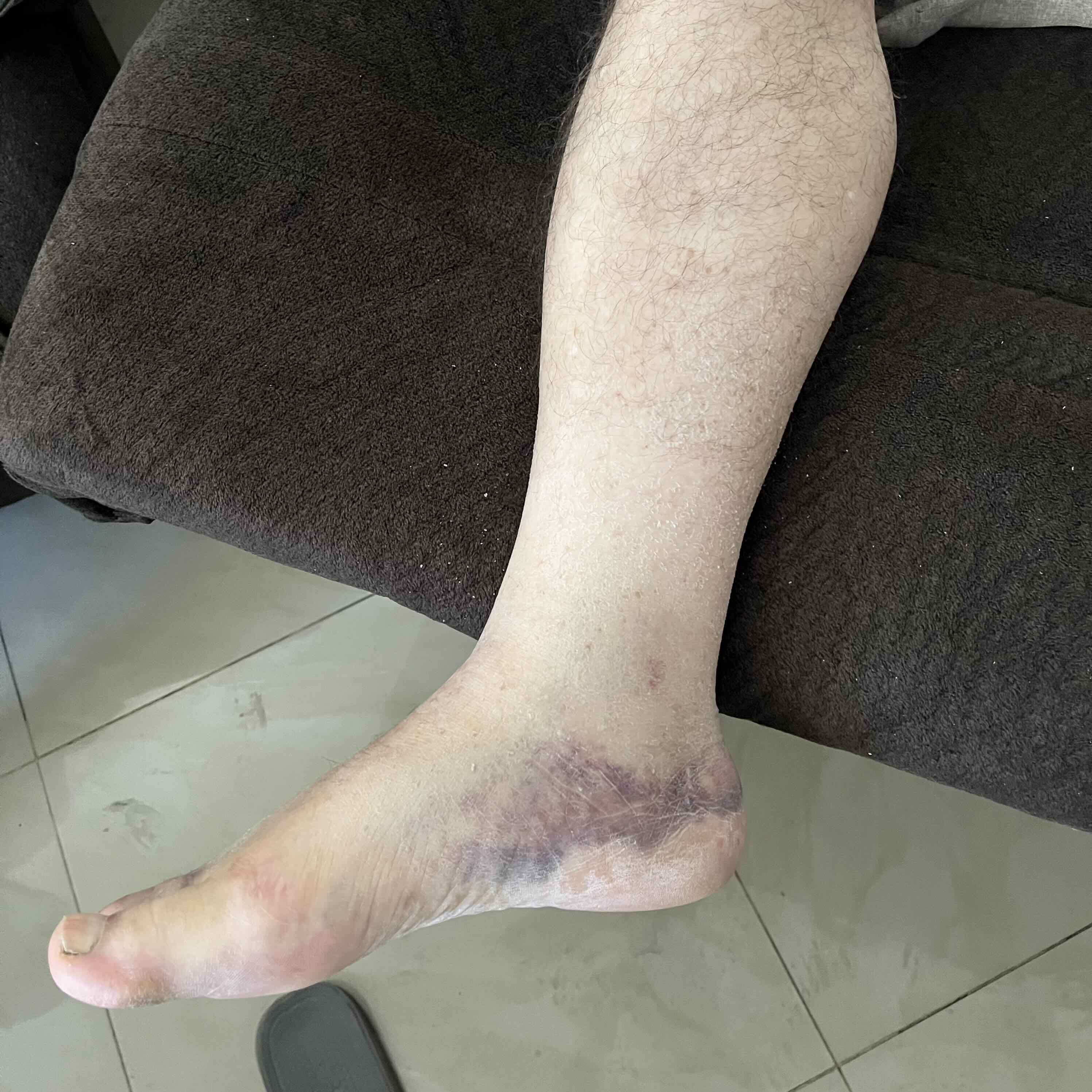 image_1_ankle